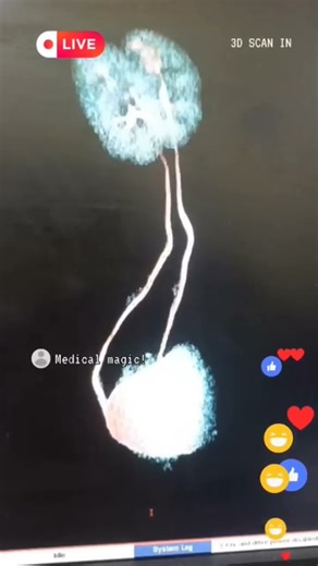 How Your Kidneys Work #shorts #radiography