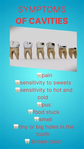 SYMPTOMS OF CAVITIES #dentist #smiledesigndental #teethdecay #love #healthyteeth