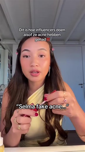 Selma's Skincare Journey: Tackling Fake Acne