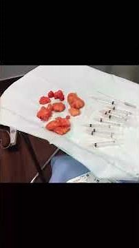 PART 2: Multiple Lipoma Removal