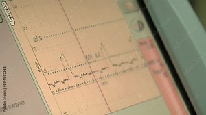 Medical Monitor Displaying Vital Signs and Respiration Graphs in Hospital - Close Up