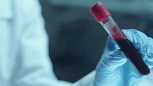 Hand Unrecognizable Doctor Sterile Glove Holding Stock Footage Video (100% Royalty-free) 3503949115 | Shutterstock