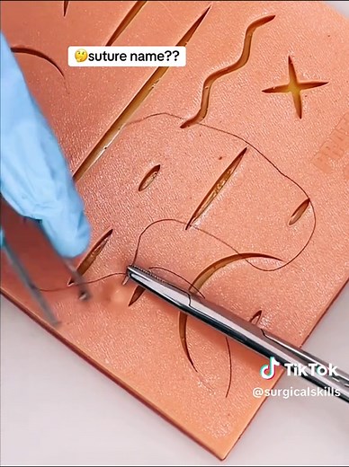 Understanding Suture Types in Surgery