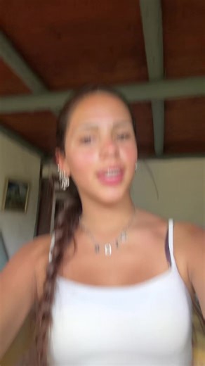 i’m sunburnt.. | sunburn