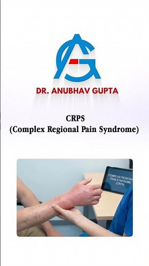 Complex Regional Pain Syndrome (CRPS) Explained | Reflex Sympathetic Dystrophy & Causalgia