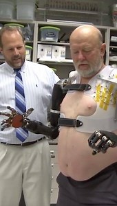 Conoce la historia de este hombre que perdió sus brazos, pero gracias a la #ciencia ha logrado cambiar su vida y recuperarlos, conoce todo el proceso que llevó y cómo funcionan estas prótesis robóticas. | Muy Interesante México