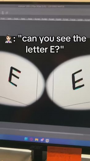 Everybody Hates Chris on Instagram: "the drift was so bad that she had to call in for help to measure my eyeballs. i don't have enough PTO to be out for 2 weeks yet 😭 #lazyeye #exotropia #eyeconditions #optometry #optometrist #art #artist #illustration #drawing #eyes #animatic"