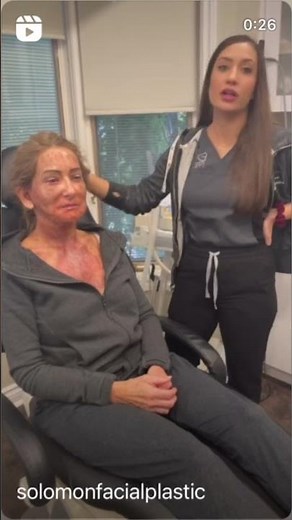 Stages of Deep Plane Facelift Recovery | Day 3 | Solomon Facial Plastic