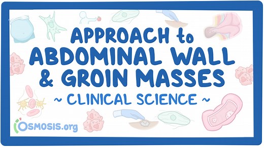 Approach to abdominal wall and groin masses: Video & Meaning | Osmosis