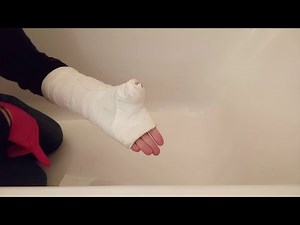 The Reusable Short Arm Cast with Thumb Spica (SATS) - Part 1: How to put the cast on