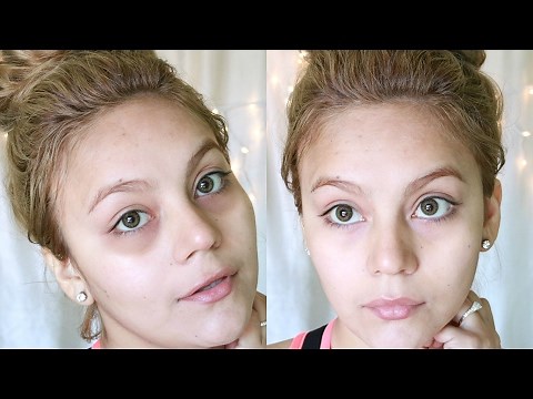 INCREDIBLE HOW TO ELIMINATE DARK CIRCLES IN DAYS | EFFECTIVE AND NATURAL