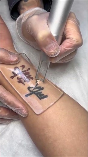 Tattoo Removal Hack: The PFD Patch! 🤯