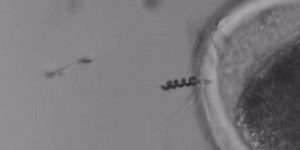 Steerable, Motorized Cyborg Spermbots Take on Infertility