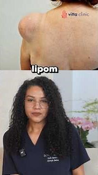 Do you have a growing LIPOM? When should you have surgery? 🩺