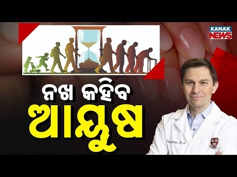 Special Report: Nail Growth Rate | Your Life Span & Health Secret! Dr. Sinclair Research.