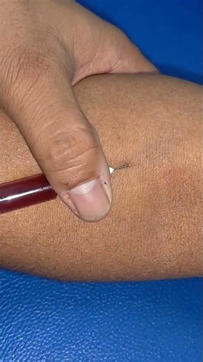 IV injection technique #sui kaise #trending #viral #ivinjection #intravenousinjection #shortvideo #