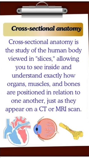 What is Cross Sectional Anatomy?And Why You NEED It🧠#shortsfeed#crosssection #bodystructure#anatomy
