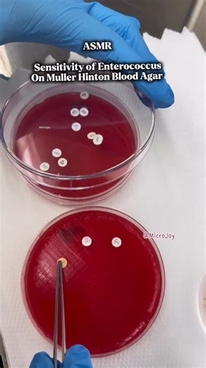 Micro_Joy on Instagram: "Sensitivity of Enterococcus🤩 Microbiology ASMR 😍 #lab #bacteria #lablife #asmr #microbiologist"