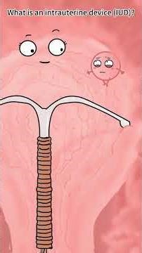 What is an intrauterine device IUD