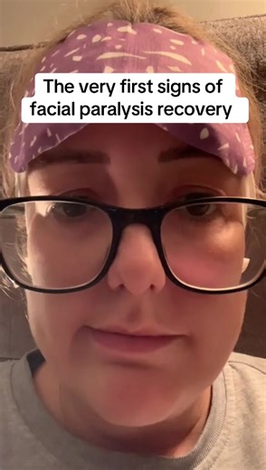 Recovering from Facial Nerve Decompression Surgery