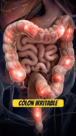 Irritable Bowel Syndrome: This food is ruining your morning! ☕❌