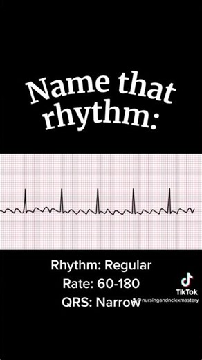 NCLEX Cardiac Rhythm Strip: Quick ECG Challenge