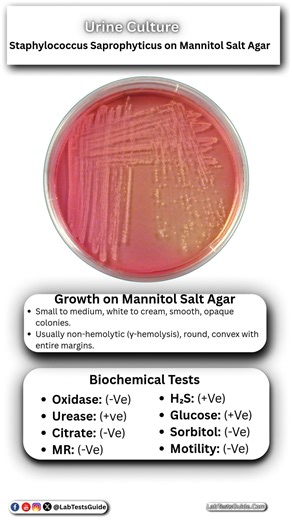 Lab tests guide on Instagram: "Staphylococcus Aureus on Mannitol Salt Agar in Urine"