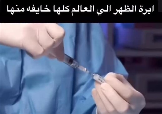 ‎عذراء حامـــد| تخدير و عناية مركزة_محتوى يومي‎ on Instagram‎: "هل تعرفون شنو يعني Spinal anesthesia؟ Spinal anesthesia هي إدخال Local anesthetic مباشرة بالSubarachnoid space بين L2-L3 أو L3-L4، بحيث المخدر يوصل مباشرة للCSF ويوقف انتقال النبضات العصبية من الأسفل للأعلى. هاي الطريقة تعطي onset سريع وفعالية عالية للعمليات السفلية مثل الولادة أو جراحة الرجلين، وتحتاج دقة عالية لتجنب المضاعفات. ليش الجرعة بالSpinal أصغر من أي طريقة ثانية؟ لأن المخدر يوصل مباشرة للCSF بدون حاجه لعبور الأنسجة، لذلك ك