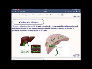 Pathology: Hepatobiliary system #3