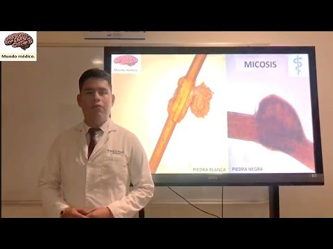 Piedra blanca y Piedra negra | Micosis superficiales