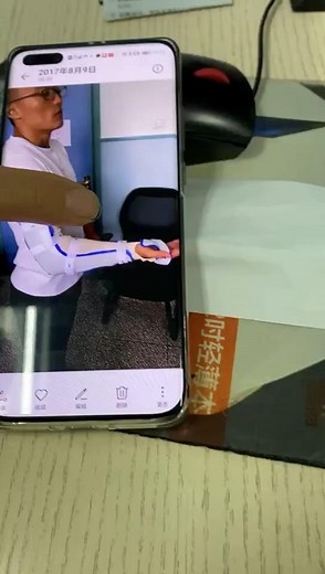 刘波讲解tfcc固定和活动方式