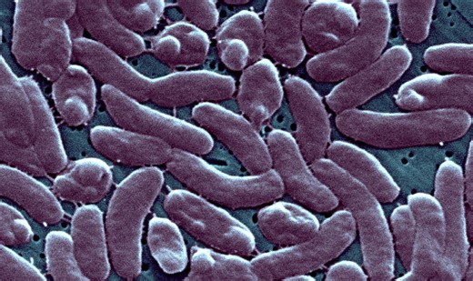 CDC warns doctors to be on alert for cases of flesh-eating bacteria Vibrio vulnificus