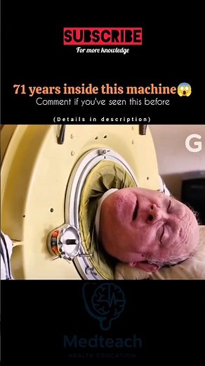 “Man Lived 71 Years Without Lungs 😮 | The Iron Lung Miracle Explained” #lungcapacity