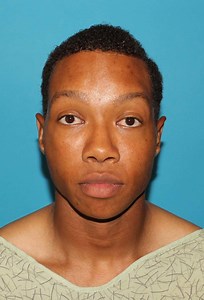 V-Line Surgery Houston | Chin Reduction Surgery | Face Forward