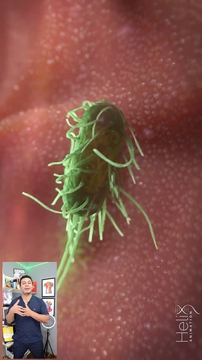 Asi trabaja nuestro sistena inmune creditos por la animacion a Helix Animation | contenidomedico.bruno