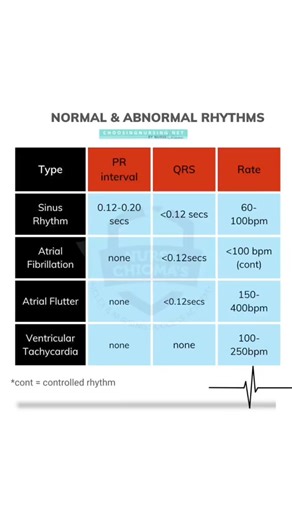Here's how to breakdown EKG rhythms. #ekgs #ecg #ecgtechnician #ekgrhythms #nursingstudent #nursesoftiktok | Nursing School Success with Choosing Nursing