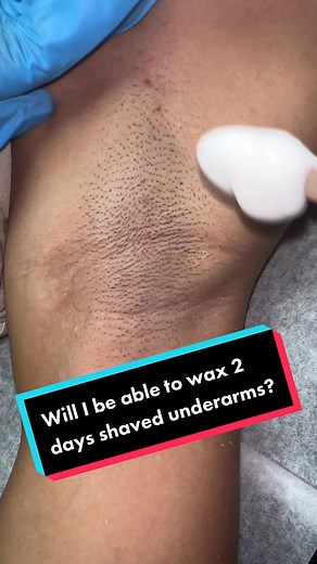 Nothing is impossible with me 💪🏾 These underarms were shaved 2 days ago but @dnawaxsupply “Moonlight Wax” and my blessed hands were ready for battle! 🫶🏾 #estheticiantiktok #waxerlife #satisfying #waxingqueenadventures #fyp #foryou #educationalpurposes #underarmwax #underarmwaxing #anythingispossible #wax #waxing #waxingvideos #waxingtiktok #viral #dnawaxsupply #skills #tricks
