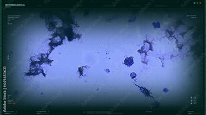 Medical Software is performing the Biological analysis of newest infection. Investigating the Biological structure of the virus infection. Examining the biological composition of the infection cells.