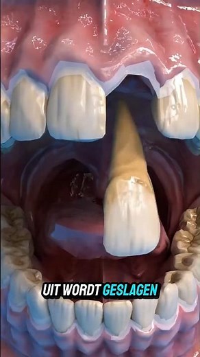 Tooth Knocked Out? This Mistake Will Cost You Everything!