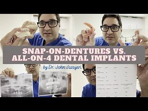 Snap-on-Dentures vs All-on-4 Implants: Understanding The Difference Between The Two