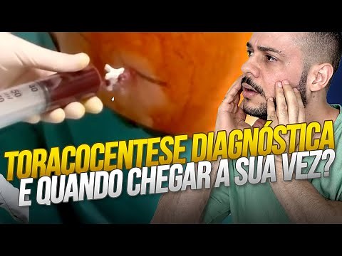 All about diagnostic thoracentesis: procedure for diagnosing and treating pleural effusion!