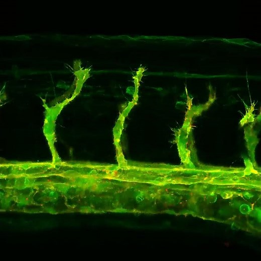 Time lapse imaging of angiogenesis in the zebrafish embryos