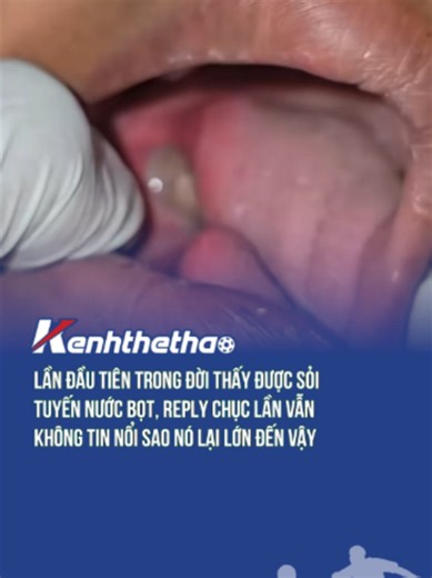Ui lần đầu tiên thấy luôn, to thực sự #soi #Btsmedia #blogtamsu #xuhuong #viral #eyeplusmedia #suckhoe