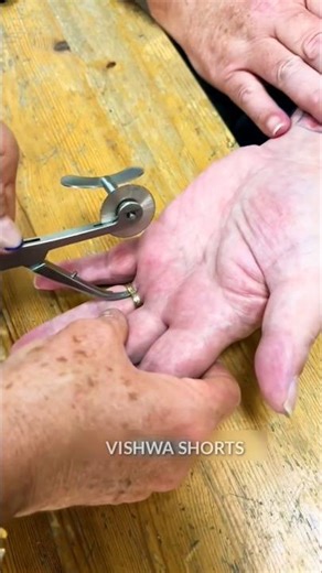 How to Remove a Tight Ring Instantly..!