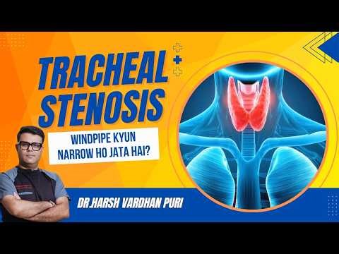 Tracheal Stenosis: Windpipe Kyun Narrow Ho Jata Hai? | Expert Explain