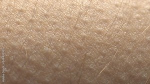 Goosebumps macro. Hair on the hand rise up. Skin reaction to cold, fear, or good music. Horripilation on skin.