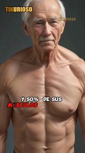 Se debe evitar el Síndrome de la Fragilidad. El Síndrome de la Fragilidad se caracteriza por pérdidas multifuncionales que llevan al adulto mayor a una condición de capacidad reducida de adaptación al estrés. Se estima que entre el 10% y el 27% de la población de más de 65 años y el 45% de la población de más de 80 años sufren el Síndrome de la Fragilidad. Son aproximadamente 2 millones de ancianos en esta condición, en Brasil. La imagen de un anciano en estado frágil es una persona físicamente 