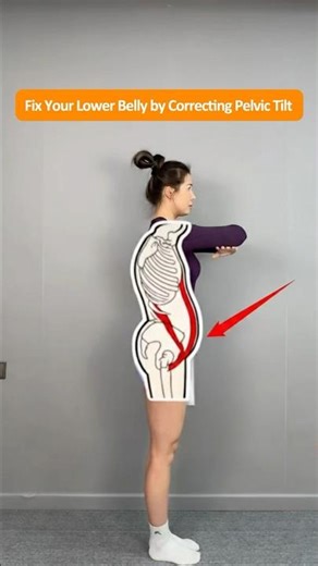 This Lower Belly Is Caused by Anterior Pelvic Tilt, Not Body Fat – Fix It With 3 Moves