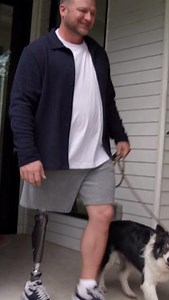 1.5K views · 24 reactions | With the C-Leg, Shima and Chance can depend on the most studied microprocessor knee in the world.  Click the link to learn more and request a trial! https://ow.ly/GInN50SRkX3 #CLeg #Prosthetic #Adaptive #OP #ChooseProvenPerformance | Ottobock | Facebook