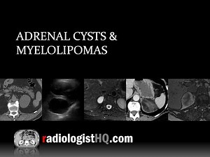 Adrenal Cysts and Myelolipomas